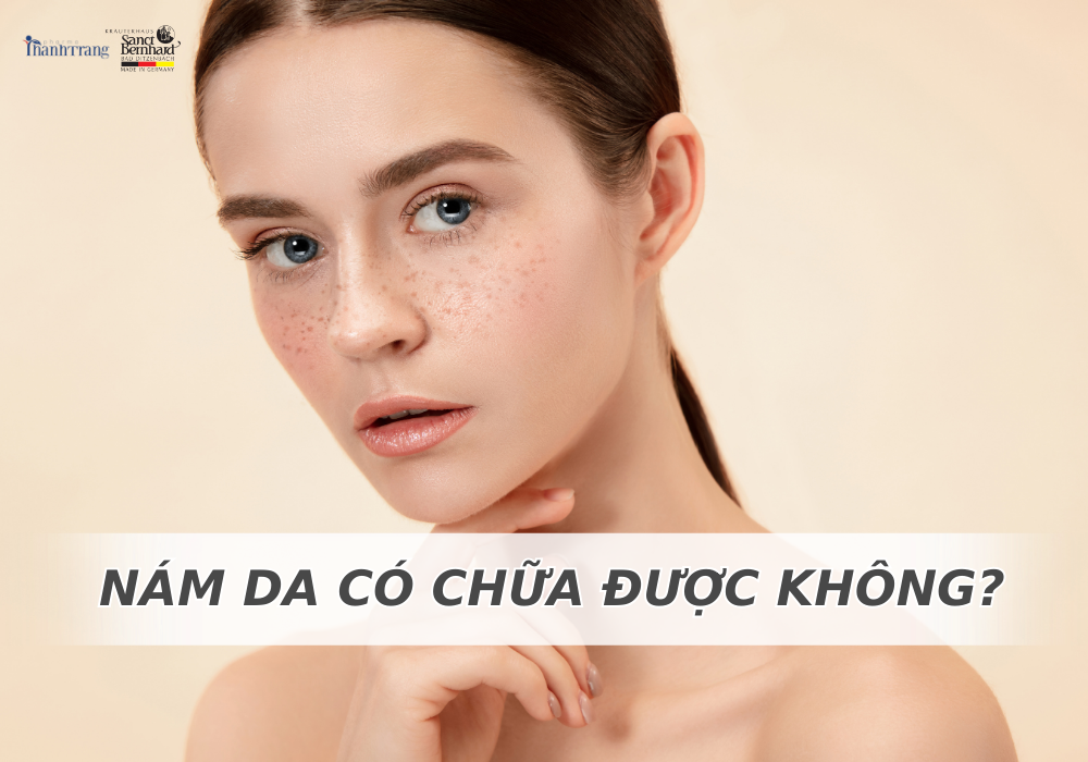 NÁM DA CÓ CHỮA ĐƯỢC KHÔNG? BẬT MÍ BÍ QUYẾT ĐÁNH BAY NÁM TẠI NHÀ